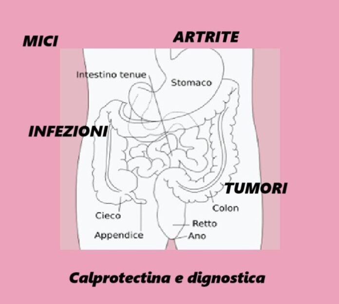 Quanto è attendibile l'esame della calprotectina e cosa è in grado di rilevare?